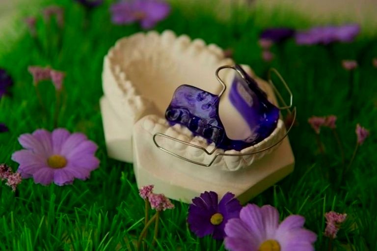 Orthodontic Treatment