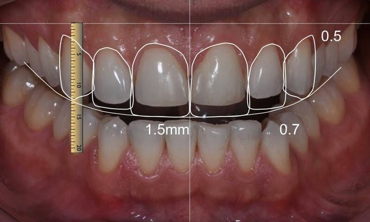 Dijital Diş Hekimliği