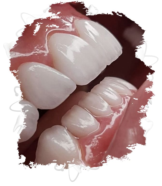 gülüş tasarımı turkiye