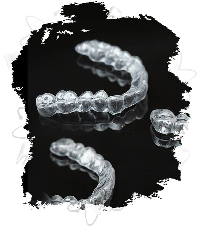 invisalign treatment