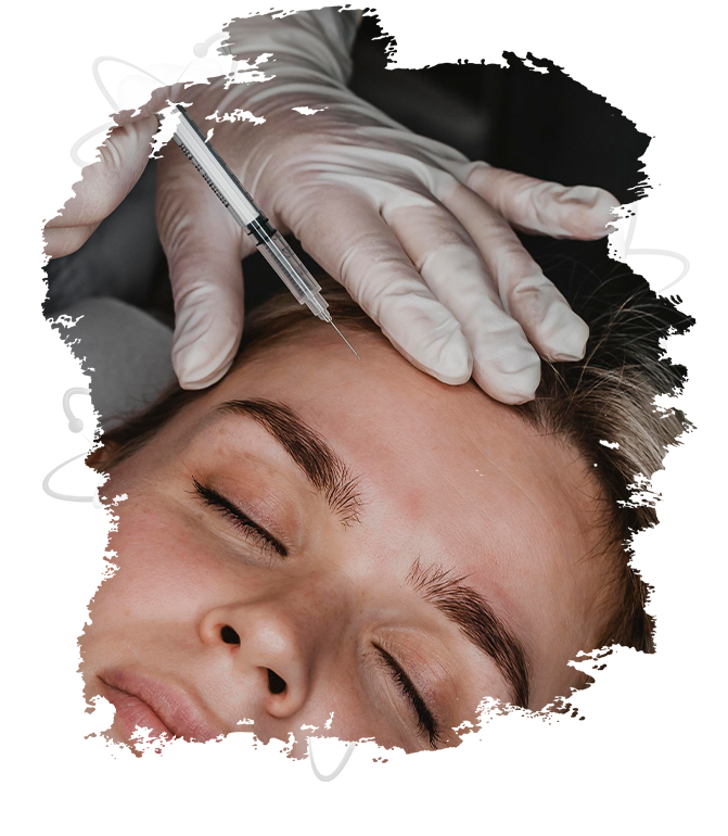 Üst yüz botoksu nedir